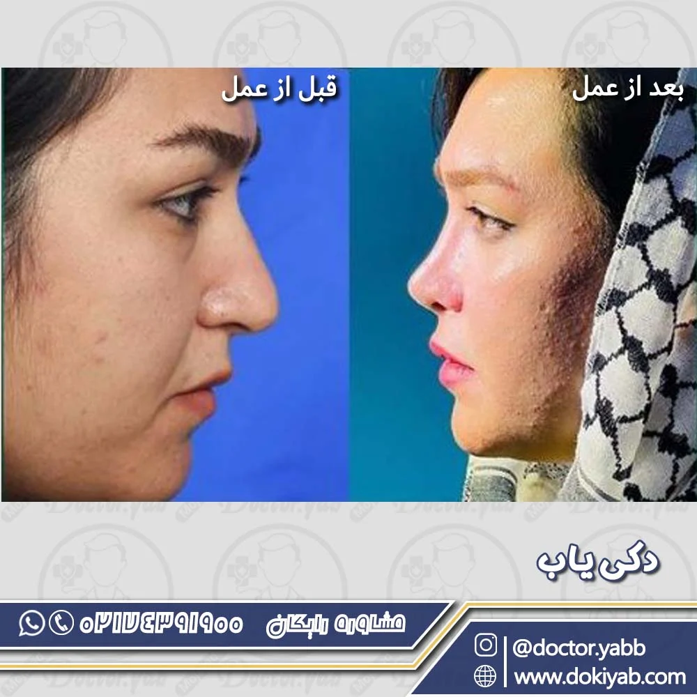 جراحی زیبایی بینی به سبک فانتزی عروسکی، دکتر سلمان شاکری
