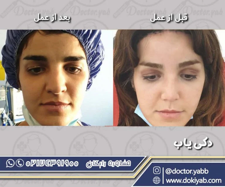 نمونه کار دکتر بهروز گندمی در شیراز