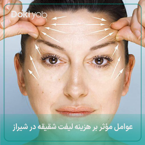 عوامل مؤثر بر هزینه لیفت شقیقه در شیراز