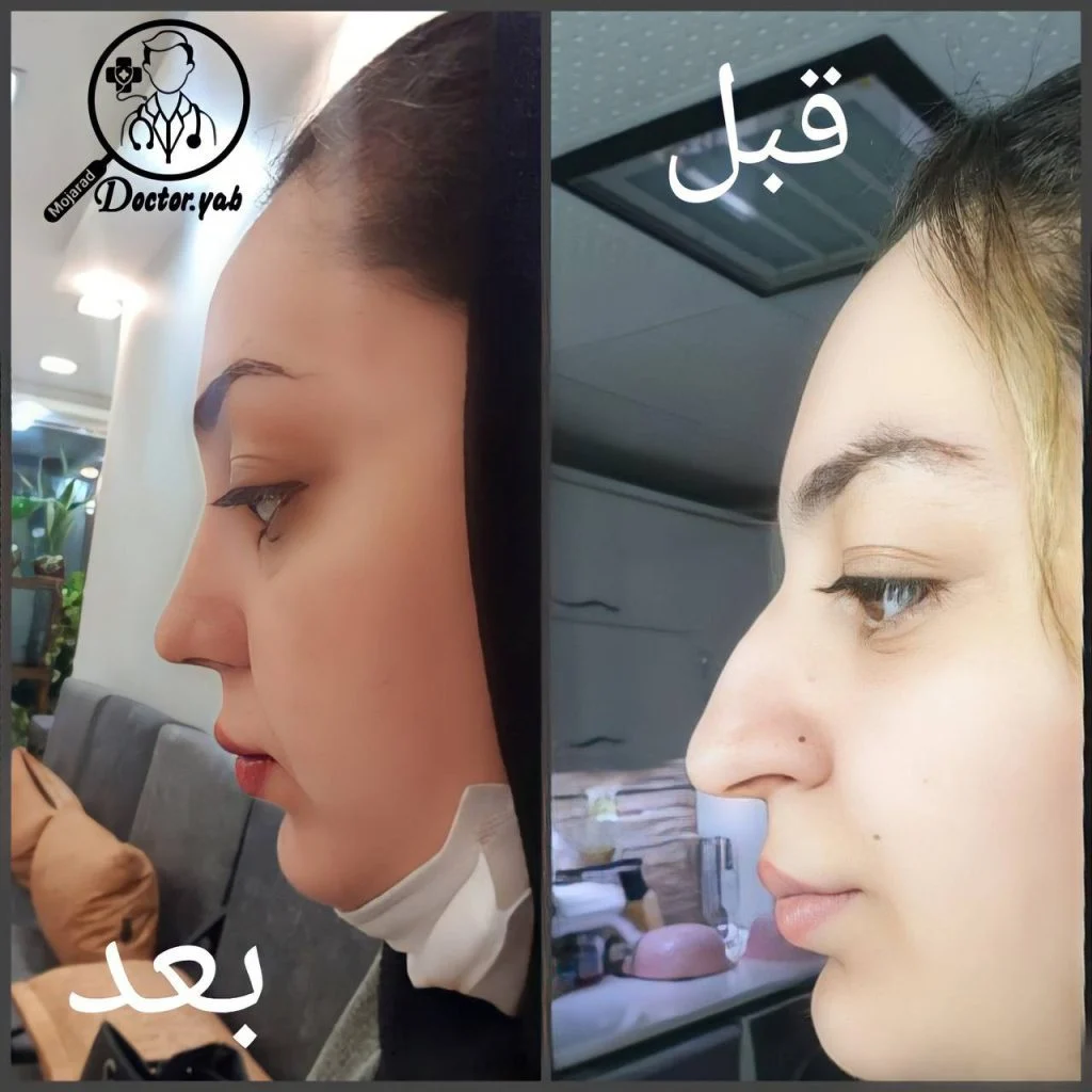 دکتر رضا کبودخانی جراح بینی در شیراز