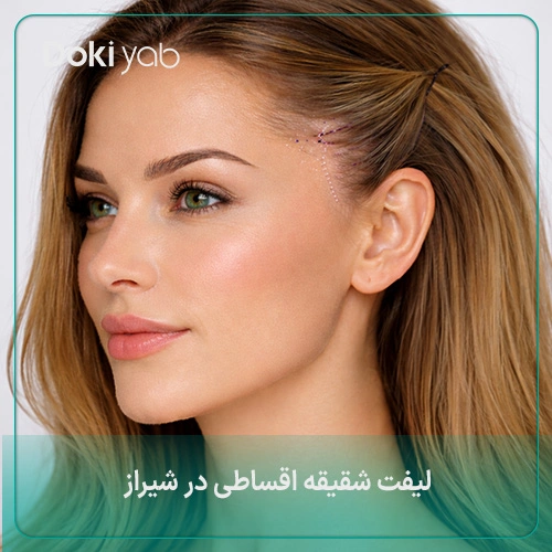 شرایط لیفت شقیقه اقساطی در شیراز