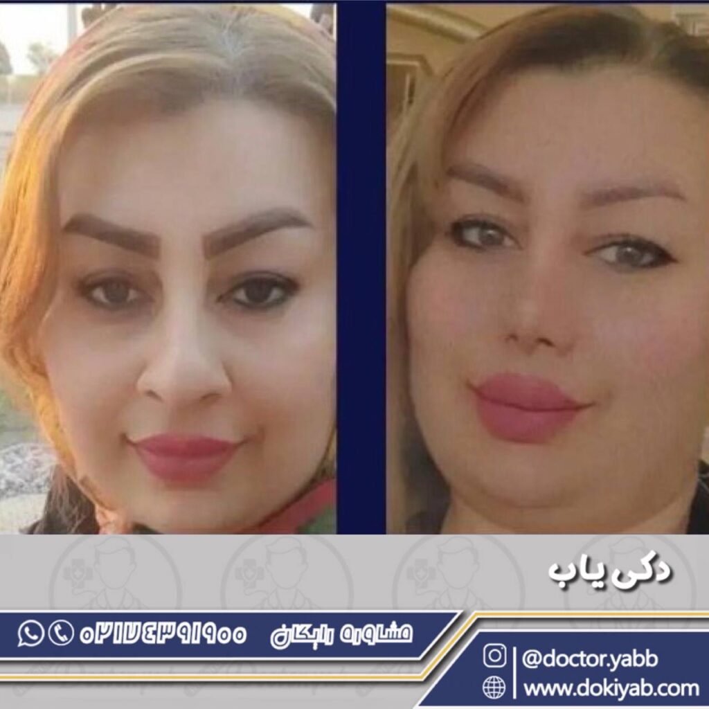 دکتر زهرا خسروی؛ جراح زیبایی بینی در شیراز