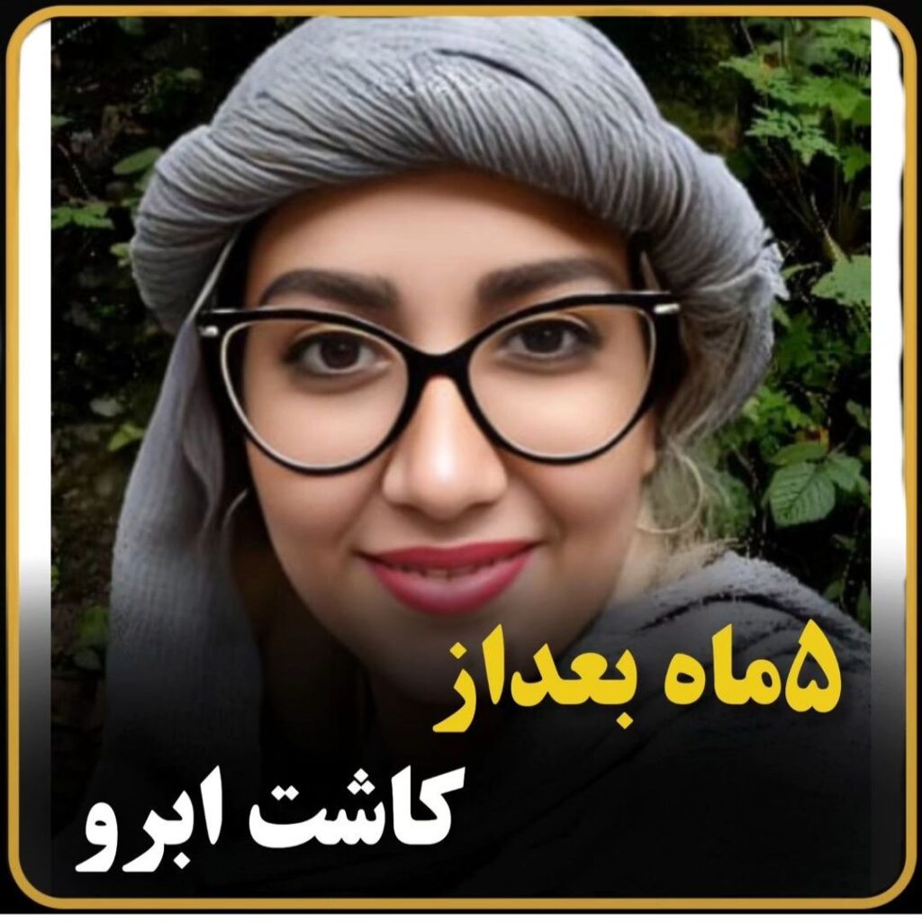 نمونه کار کاشت ابرو کلینیک آتما؛ هزینه کاشت ابرو اقساطی در شیراز