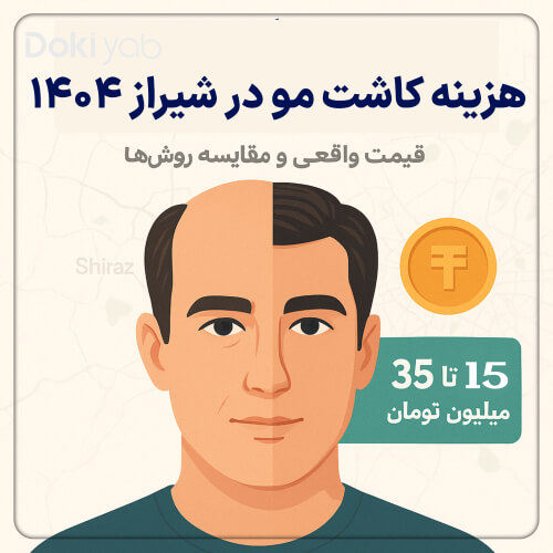 عکس شاخص مقاله هزینه کاشت مو در شیراز ۱۴۰۴ با نمایش قبل و بعد کاشت مو و بازه قیمت ۱۵ تا ۳۵ میلیون تومان