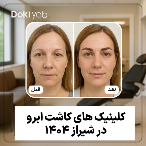 مقایسه قبل و بعد کاشت ابرو در یک زن جوان به همراه نمای داخلی کلینیک زیبایی مدرن در شیراز - معرفی ۷ کلینیک برتر کاشت ابرو در سال ۱۴۰۴