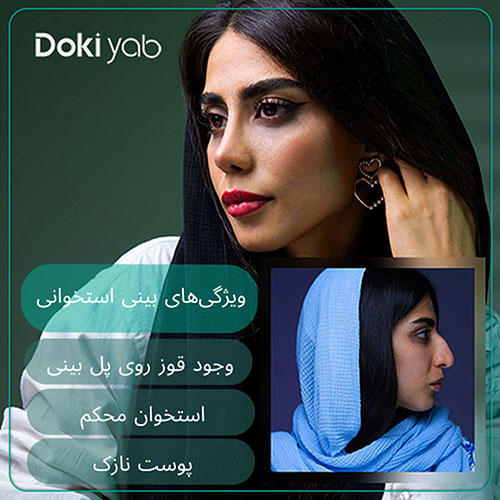 بررسی ویژگی‌های بینی‌های استخوانی