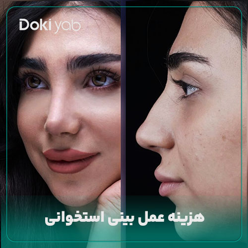 بررسی هزینه عمل بینی استخوانی با دکی یاب