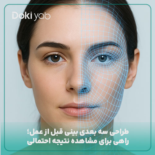 طراحی سه بعدی بینی قبل از عمل برای مشاده نتیجه احتمالی در مجموعه دکی یاب