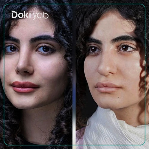 طراحی سه بعدی بینی قبل از عمل و جراحی با مشاوره مجموعه دکی یاب