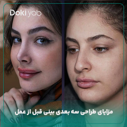مزایای طراحی سه بعدی بینی قبل از عمل در مجموعه دکی یاب
