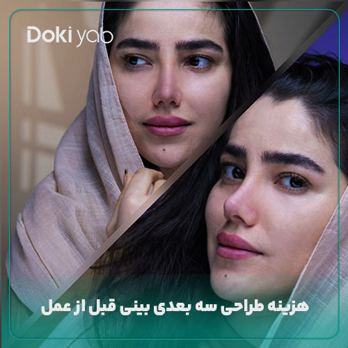 هزینه طراحی سه بعدی بینی قبل از عمل در دکی یاب