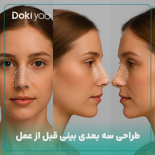 طراحی سه بعدی بینی قبل از عمل در دکی یاب