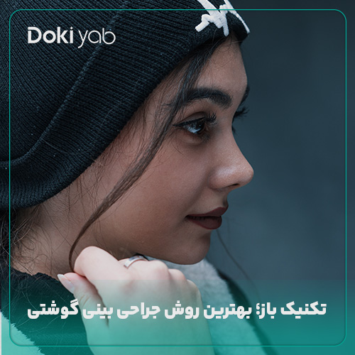 استفاده از تکنیک باز برای عمل بینی گوشتی