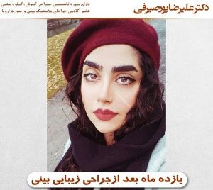 عمل بینی دکتر علی رضا پور صیرفی در اصفهان؛ مجموعه دکی یاب