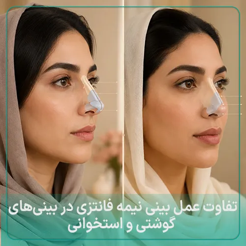 بینی نیمه فانتزی گوشتی و استخوانی