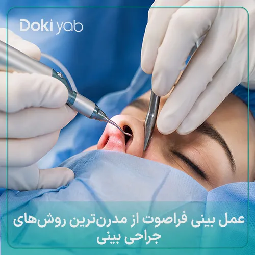 عمل بینی فراصوت با بهترین دکتر عمل بینی ایران