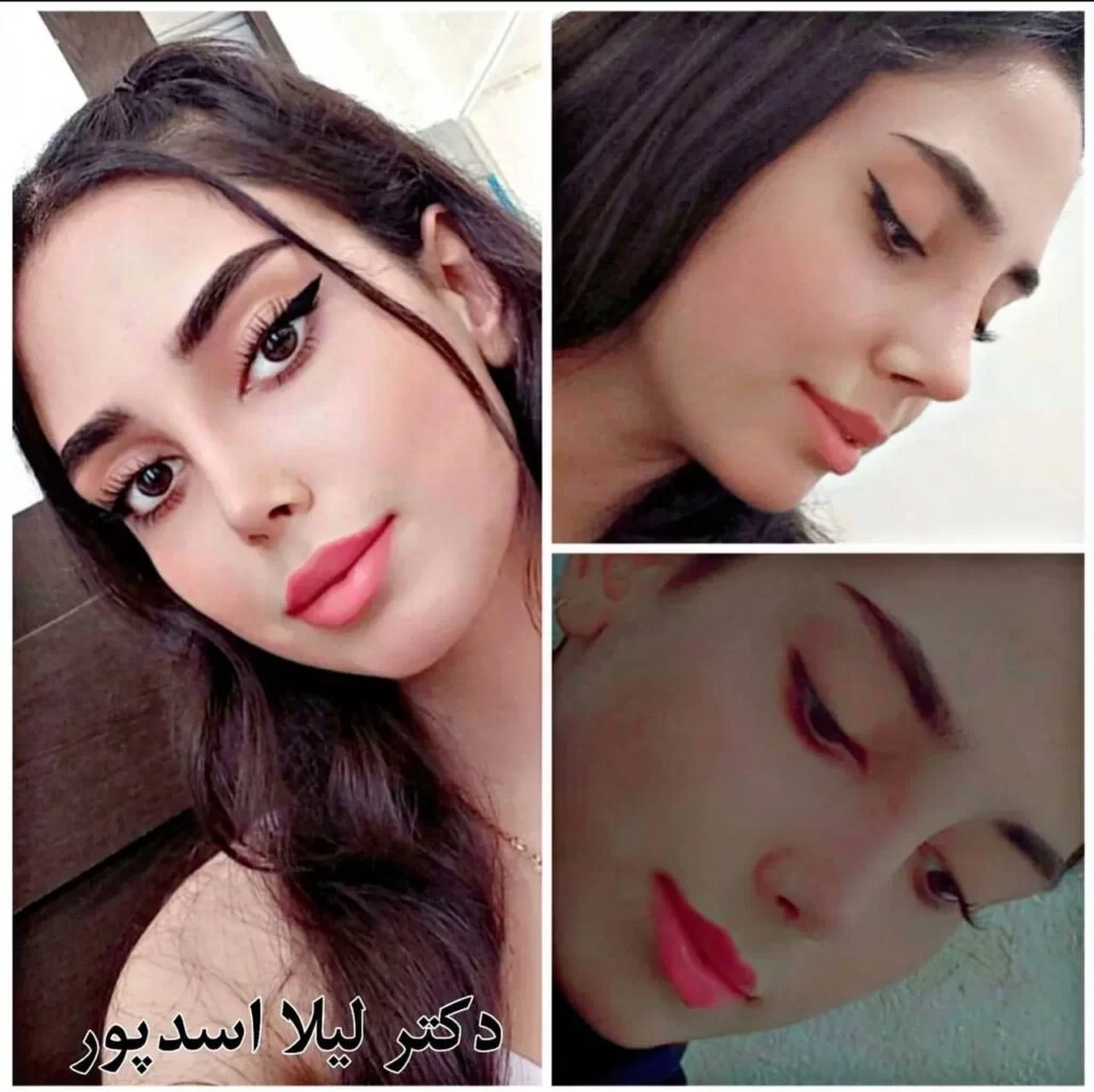 نمونه عمل بینی دکتر لیلا اسدپور در شیراز؛ مجموعه دکی یاب