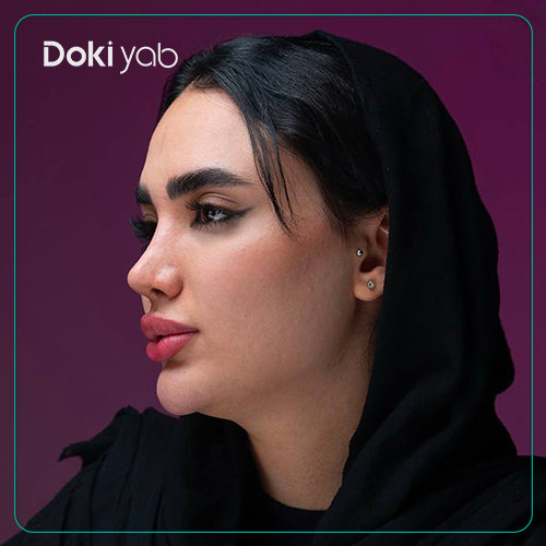 نمونه کار عمل بینی بسته دکتر حمزه هاشمی در شیراز