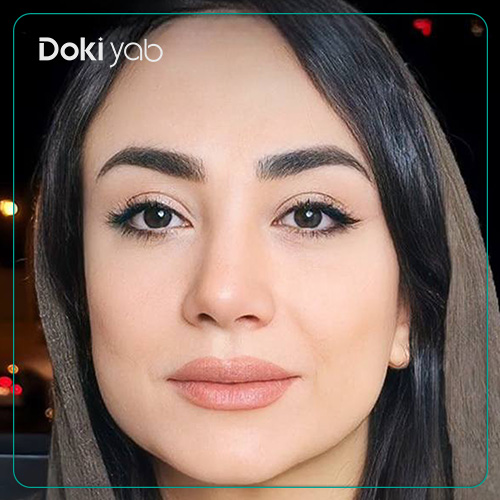 نمونه جراحی با دکتر مسیح طالع در شیراز با مشاوره دکی یاب