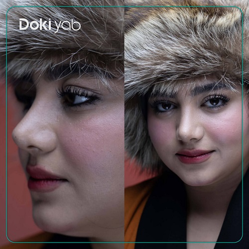 نمونه عمل بینی طبیعی دکتر سولماز قربانی؛ مجموعه دکی یاب