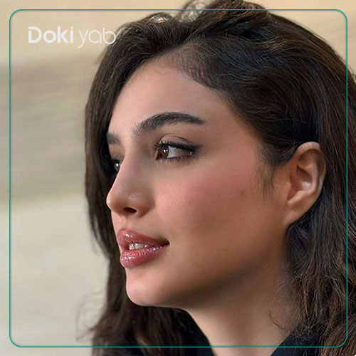 نمونه جراحی بینی توسط دکتر مسیح طالع در مجموعه دکی یاب
