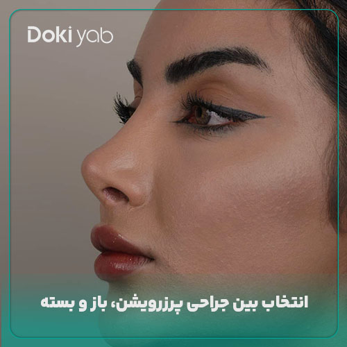 انتخاب بین روش‌های جراحی پرزرویشن، باز و بسته با مشاوره دکی یاب