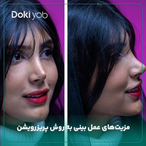 مزیت‌های عمل پرزرویشن بینی