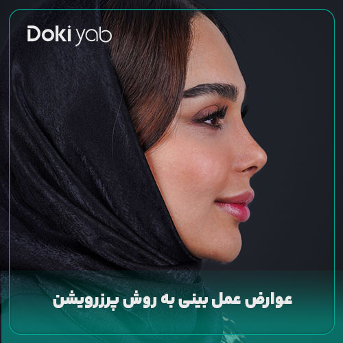 عوارض عمل پرزرویشن بینی؛ نمونه جراحی با دکی یاب 