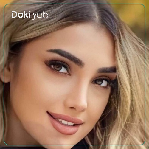 نمونه عمل بینی با دکتر شهریار یحیوی، از بهترین جراحان بینی فانتزی در تهران