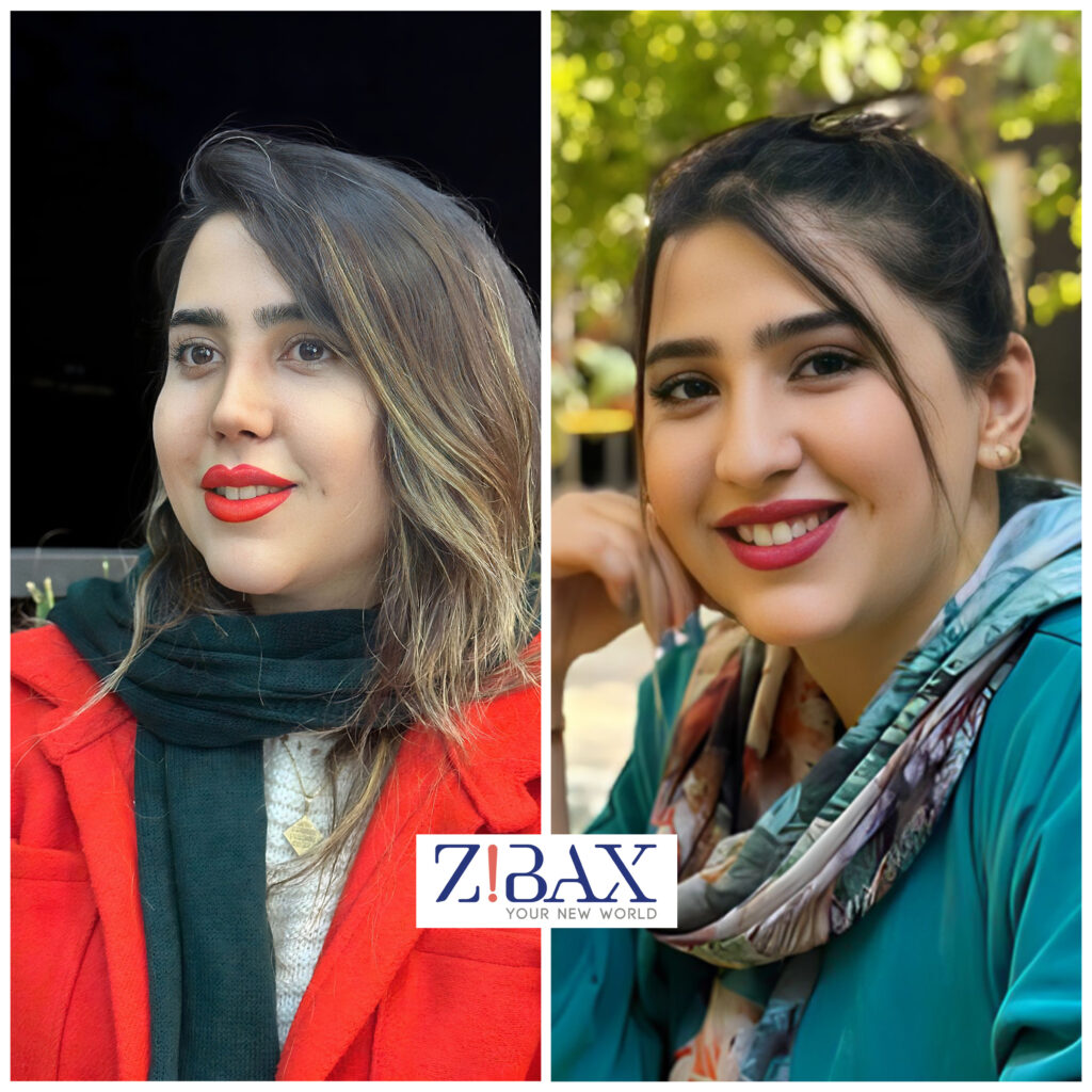 نمونه جراحی زیبایی بینی با دکی یاب؛ جراحی بینی طبیعی شیراز