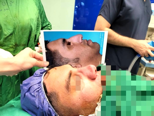 نمونه جراحی بینی دکتر علی اکبر خدابخشی در اراک