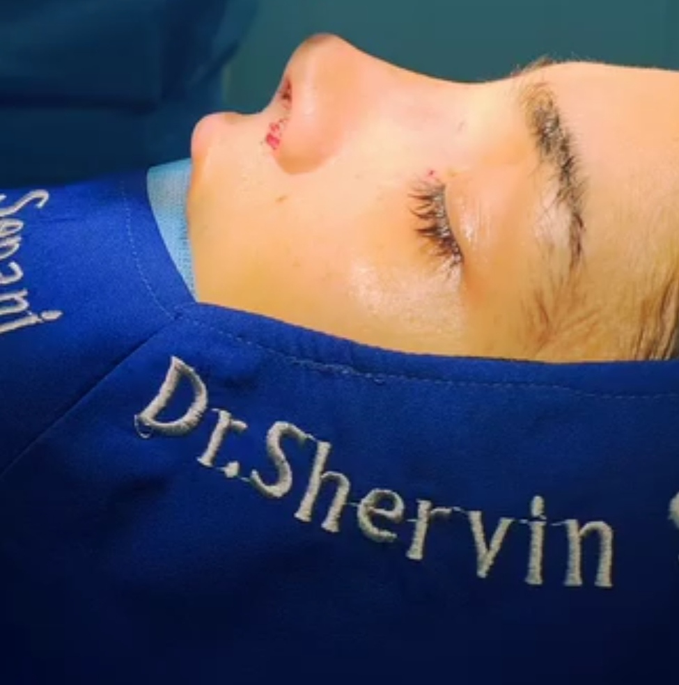 جراحی زیبایی بینی با دکتر شروین سپنج؛ بهترین جراح بینی نیمه فانتزی در تهران