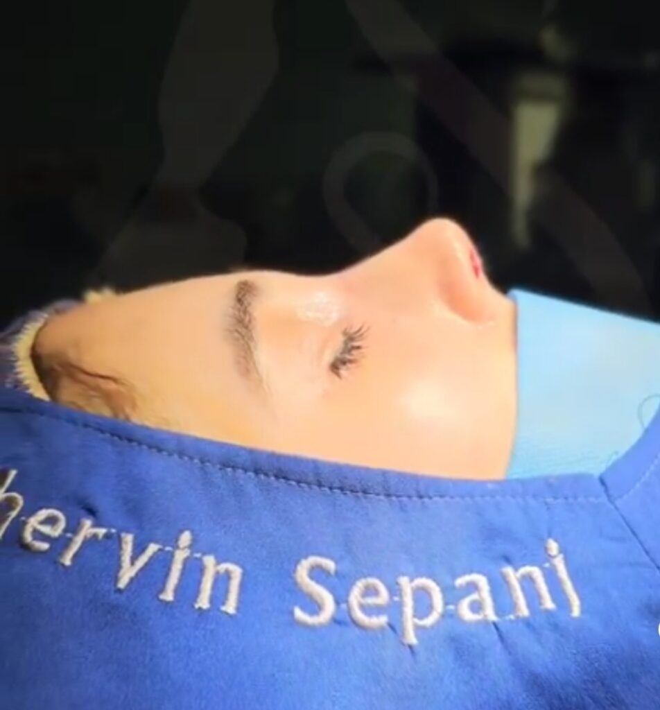 عمل زیبایی بینی دکتر شروین سپنج؛ بهترین جراح بینی استخوانی در تهران
