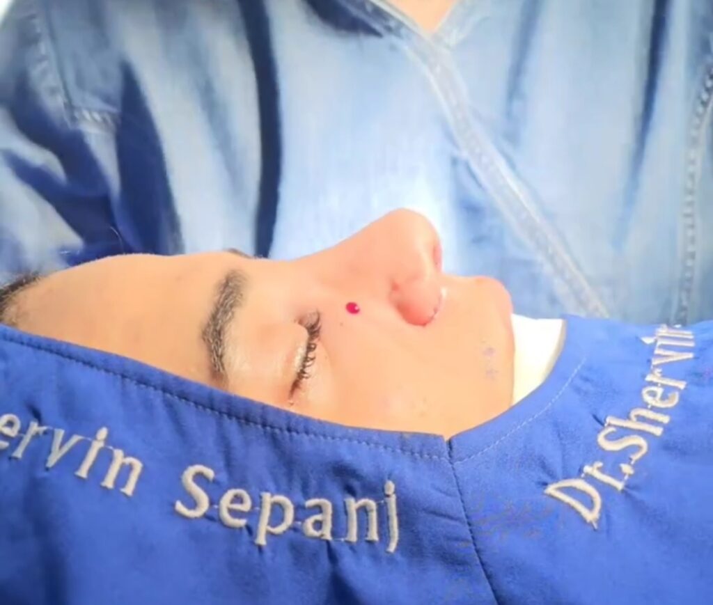 جراحی بینی دکتر شروین سپنج؛ بهترین جراح بینی استخوانی در تهران
