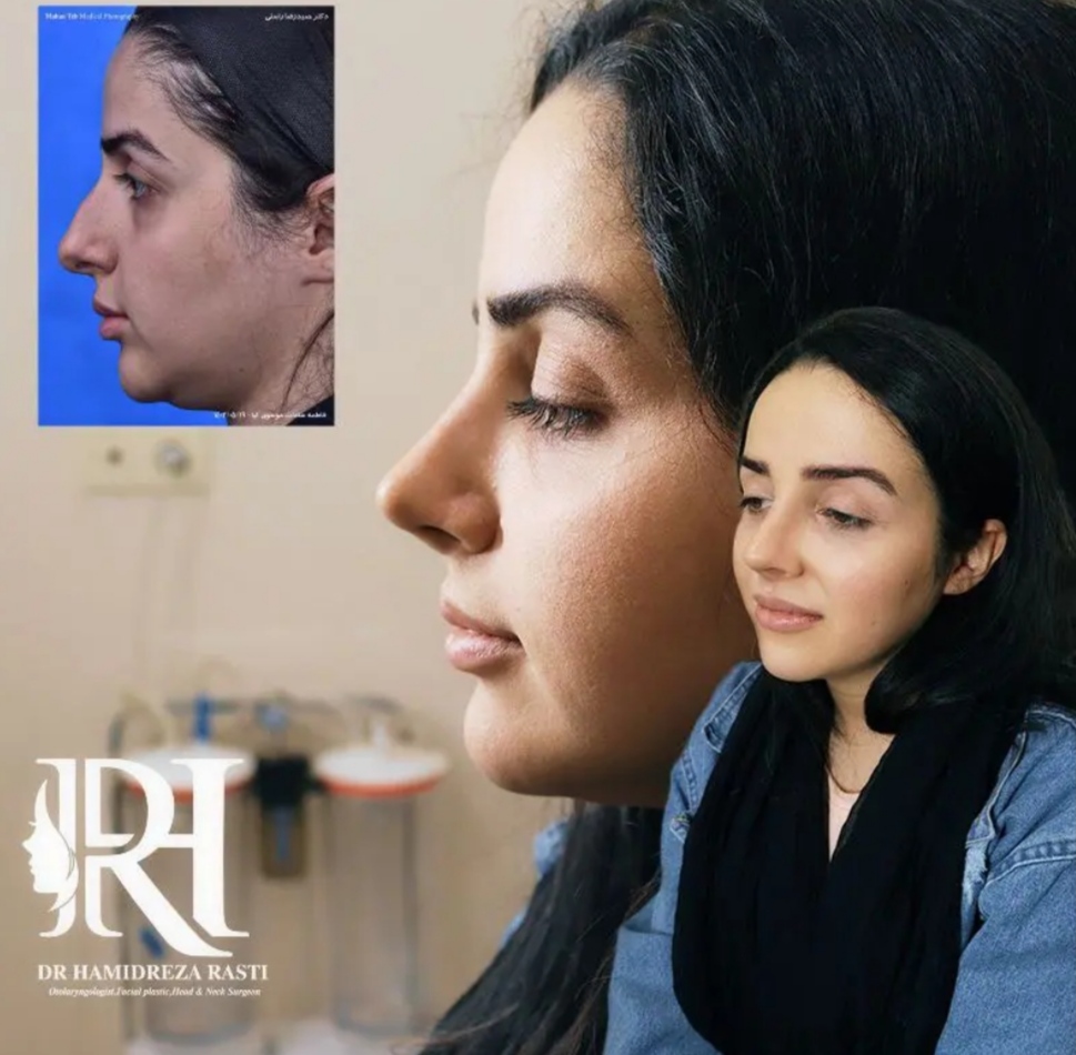 جراحی بینی دکتر حمیدرضا راستی؛ بهترین جراح بینی استخوانی در تهران