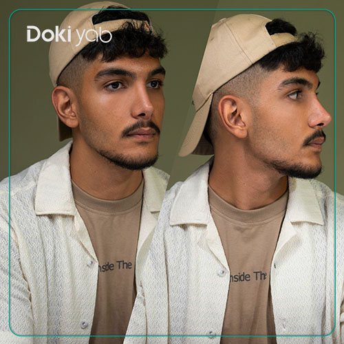 نمونه جراحی بینی با مشاوره دکی یاب