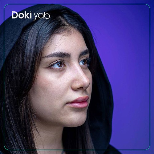 نمونه کار عمل بینی طبیعی با کمک تیم دکی یاب