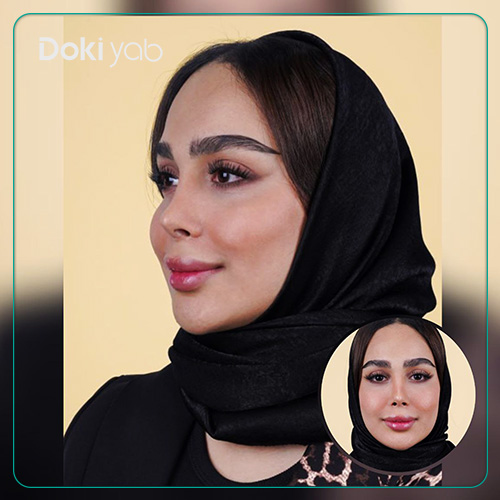 نمونه عمل بینی با مشاوره دکی یاب؛ بهترین جراح بینی گوشتی در تهران