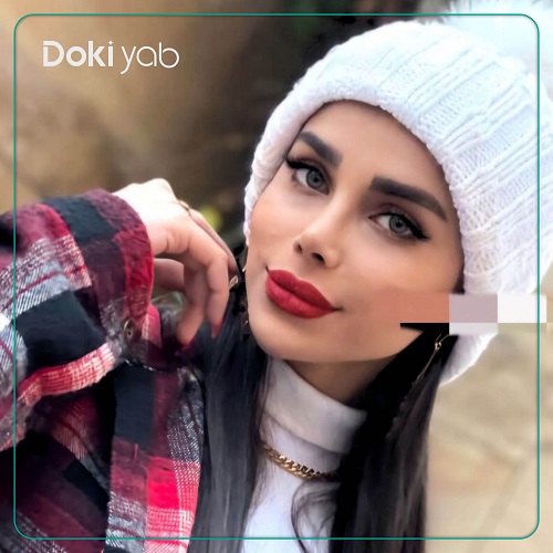 نمونه عمل زیبایی بینی با دکتر آرزو خوانساری نیا؛ بهترین جراح بینی استخوانی در تهران