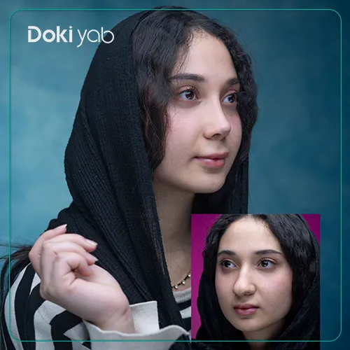 جراحی موفق بینی گوشتی با انتخاب بهترین جراح بینی گوشتی تهران از طریق دکی‌ یاب