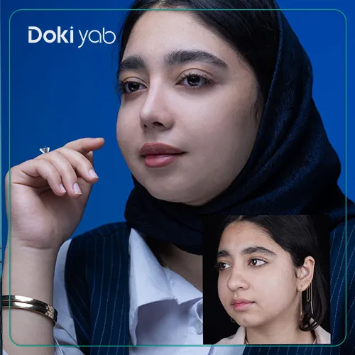 نمونه کار بهترین دکتر عمل بینی گوشتی در تهران؛ انتخاب‌شده با دکی‌ یاب