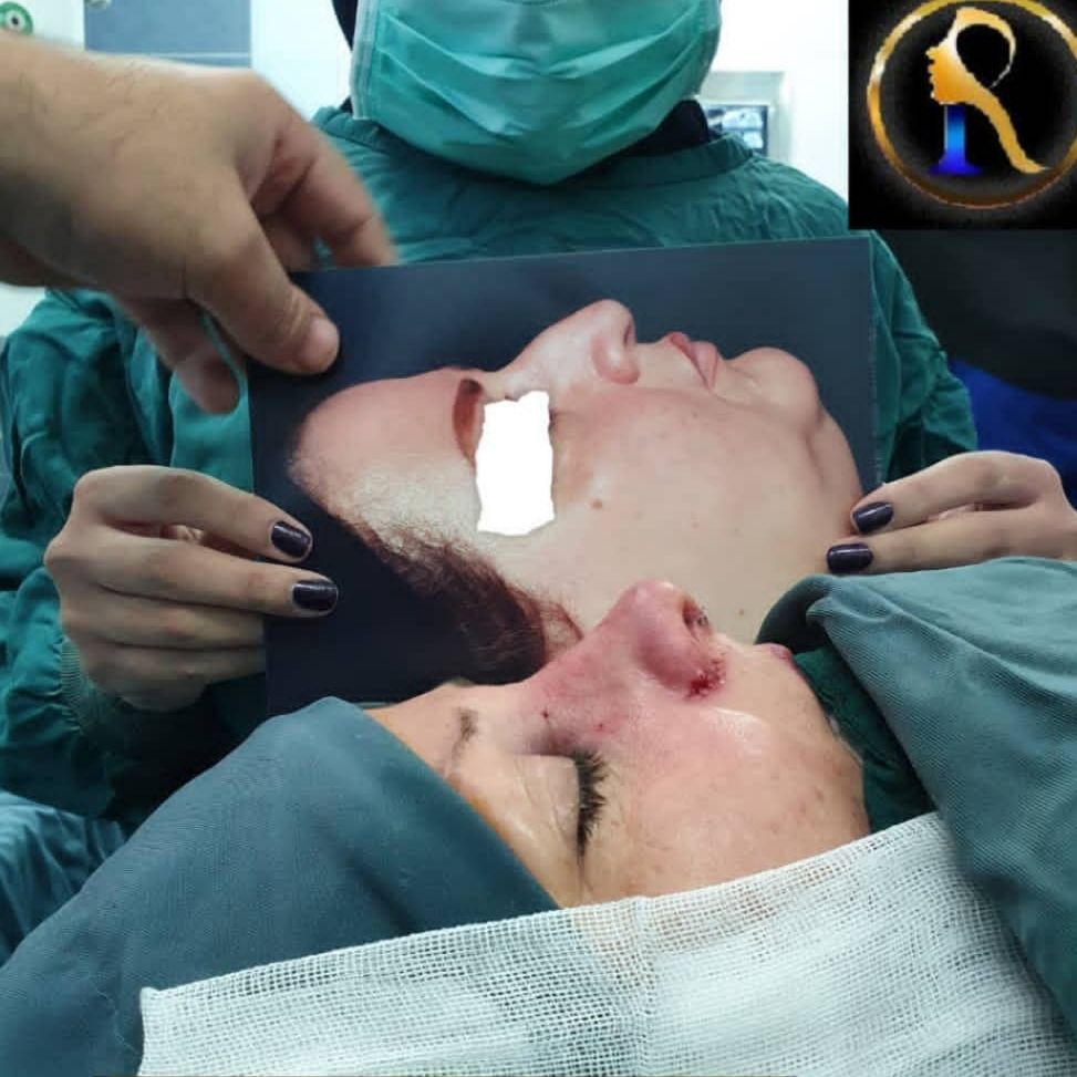 نمونه کار عمل بینی دکتر رضا انصاری؛ بهترین جراح بینی در لرستان