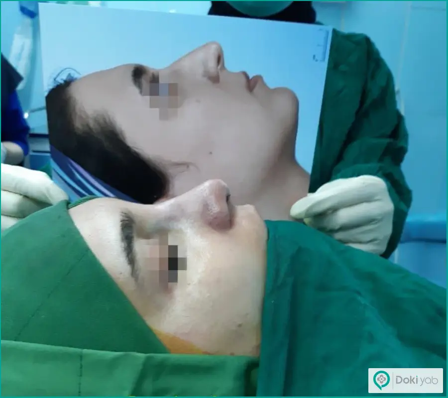 قبل و بعد جراحی دماغ زنانه دکتر فیروزه ضیا در رشت