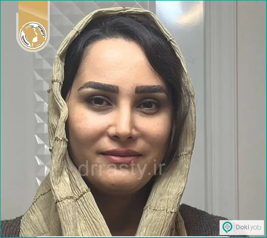 نمونه کار جراحی زیبایی بینی زنانه دکتر مجید راستی در اصفهان