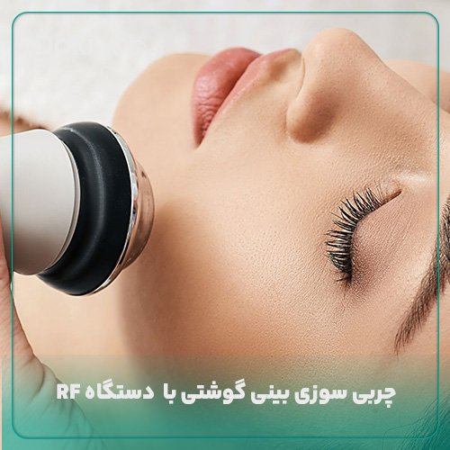 استفاده از دستگاه آر‌اف برای چربی سوزی بینی گوشتی