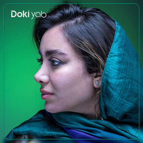 نمونه عمل بینی زنانه دکتر حمیدرضا کاظمی جراح بینی در شیراز