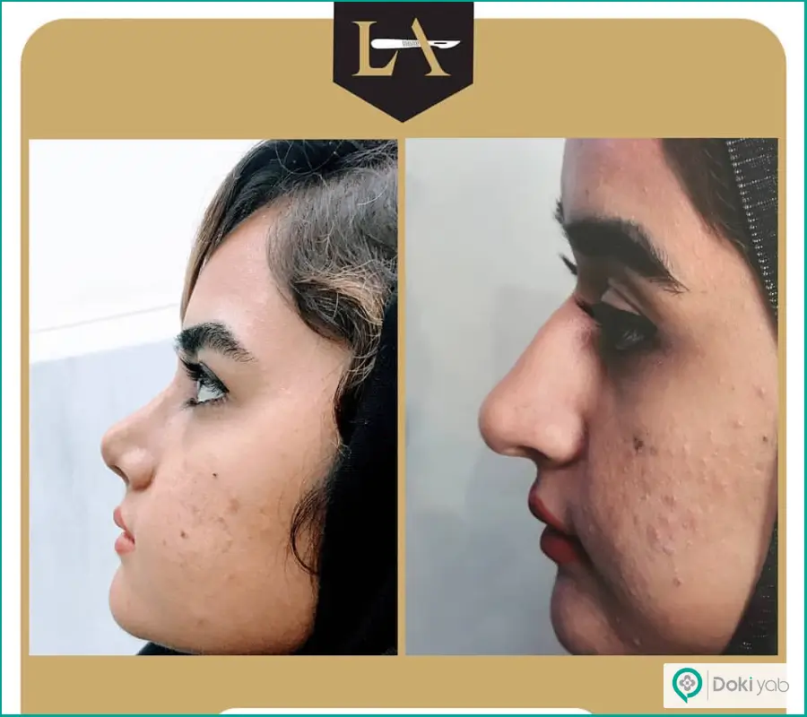 قبل و بعد عمل دماغ ترمیمی زنانه دکتر لیلا اسدپور در شیراز