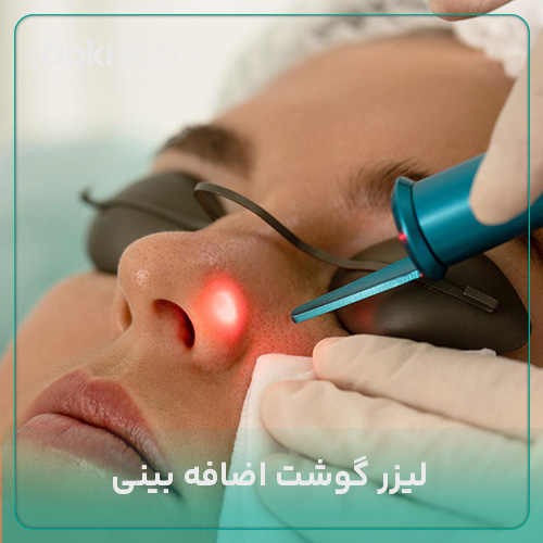  لیزر گوشت اضافه بینی بعد از عمل؛ مجله دکی یاب