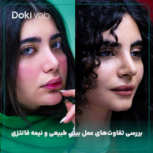 بررسی تفاوت‌های عمل بینی طبیعی و نیمه فانتزی