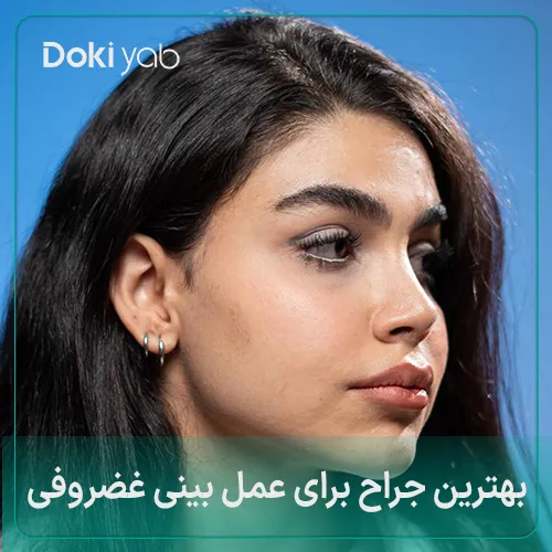  9 جراح برای عمل بینی غضروفی + عکس قبل و بعد جراحی